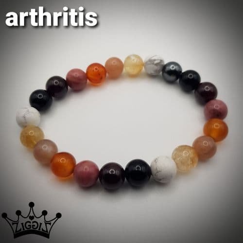 Arthritis 1