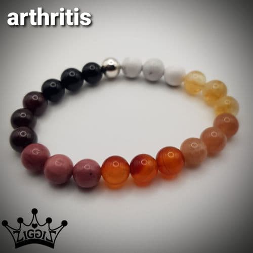 Arthritis 2