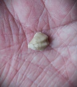Dictothyris coarctata (Parkinson 1811)