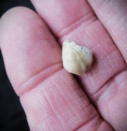 Dictothyris coarctata (Parkinson 1811)