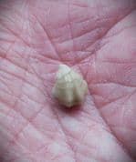 Dictothyris coarctata (Parkinson 1811)