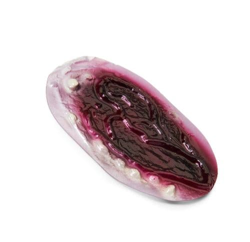 1 2 and 3 Degree Burn