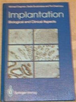 Implantation: Biological and Clinical Aspects - 0387195335