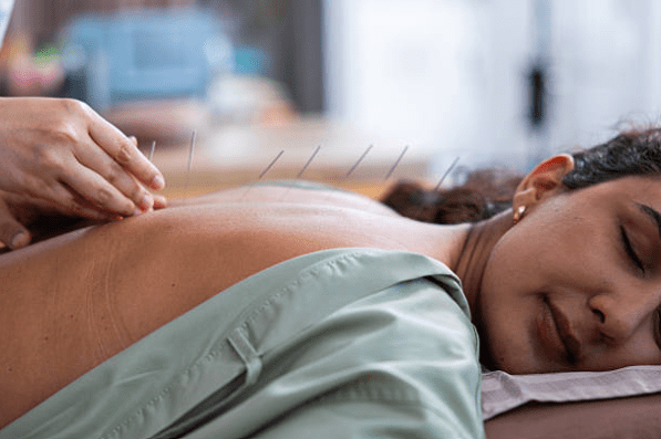 How Quality Acupuncture Supplies Improve Patient Comfort