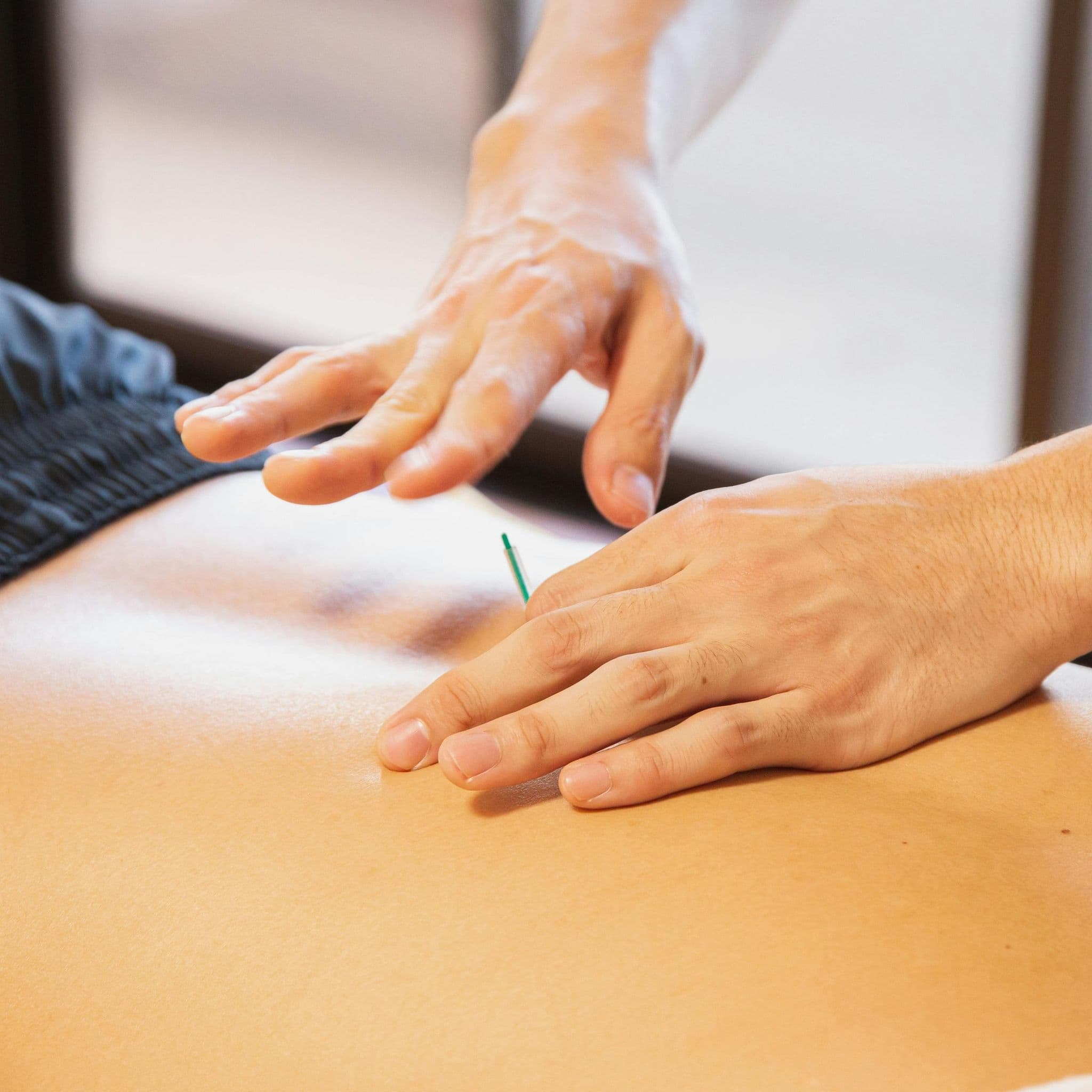 How to Maintain Hygiene and Safety in Acupuncture Practice: Best Practices and Tips