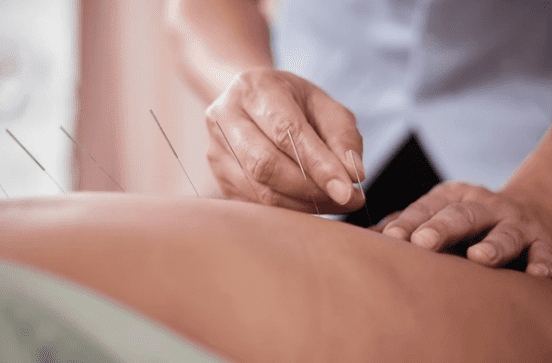 Maintaining Sterility and Safety in Acupuncture Practice