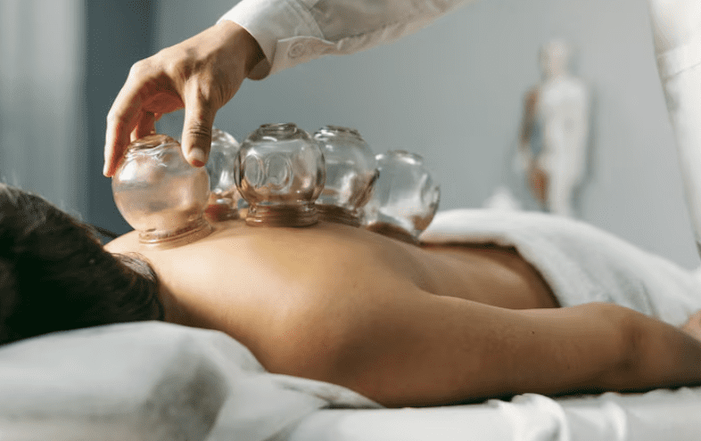 Cupping Therapy: Practitioner Guide to Techniques, Benefits & Safe Application