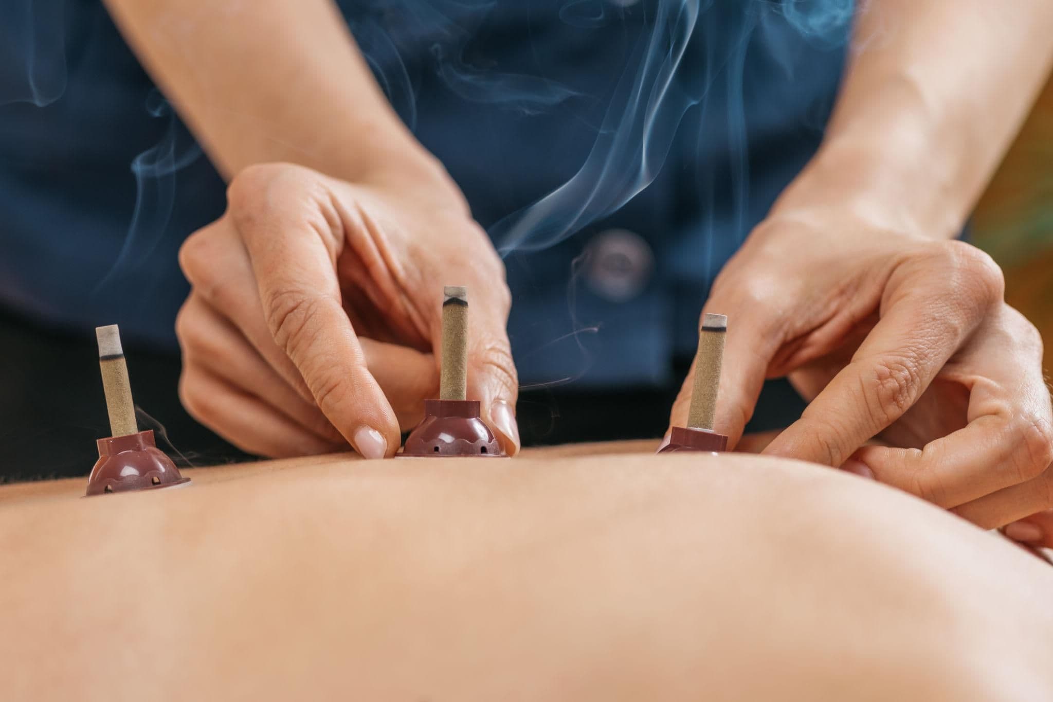How Moxibustion Supports Pain Relief and Muscle Recovery