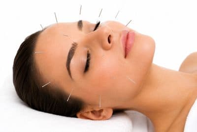 Facial Acupuncture