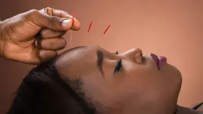Facial Acupuncture