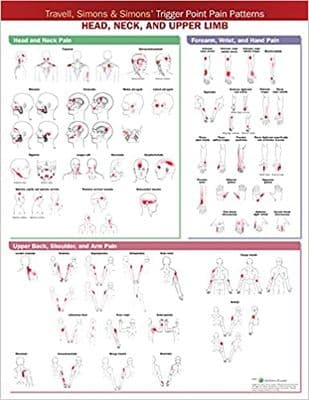 Trigger points pain chart - Head , neck & Upper limb
