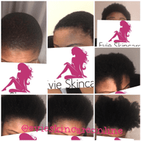 Evie Skincare Growth Oil 100ml