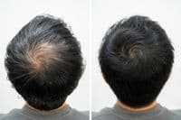 Hair Thickening Spray | Instant Hair Thickener | Hair Loss Concealer | RESTRAND