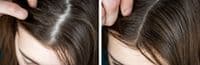 Hair Thickening Spray | Instant Hair Thickener | Hair Loss Concealer | RESTRAND