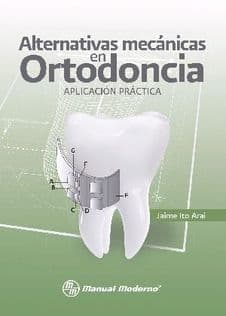 Alternativas Mecánicas (Mecanicas) en Ortodoncia Ito ISBN: 9786074482393