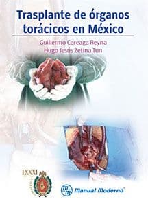 Trasplante de órganos torácicos en México Careaga ISBN: 9786074484380