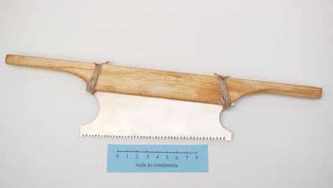 roman surgeons bronze angled bone saw british museum find