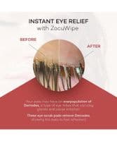 ZocuWipe Eyelid Cleansing Wipes 30 pack