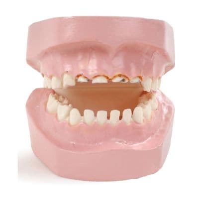 Baby Bottle Tooth Decay Model