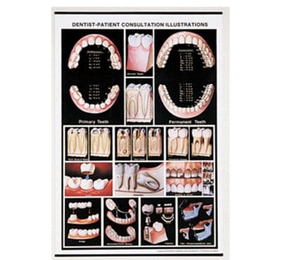 Consultation Wallchart