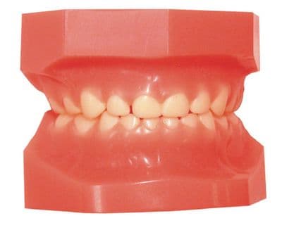 Ideal Baby Tooth Model Hinged