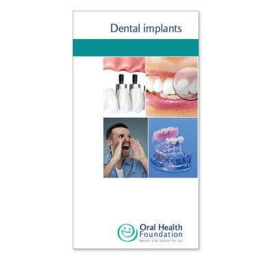 Implants' prestige leaflets