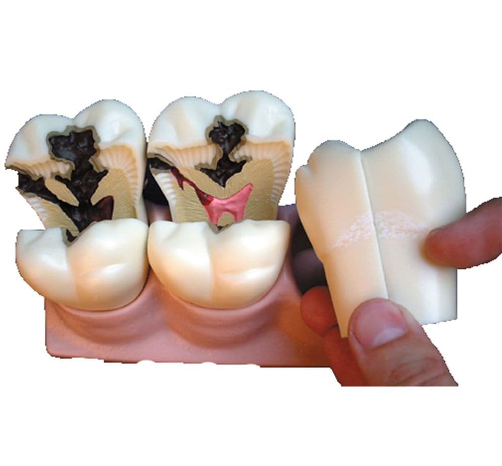 Unit 3 Model