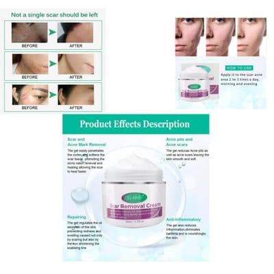 Organic scarless skin rebound cream