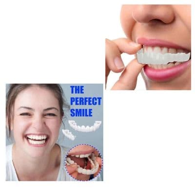 Perfect Smile Snap-On Braces