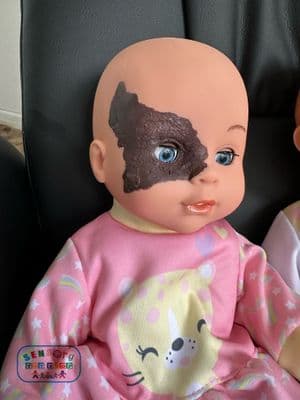 	Doll with Birthmark