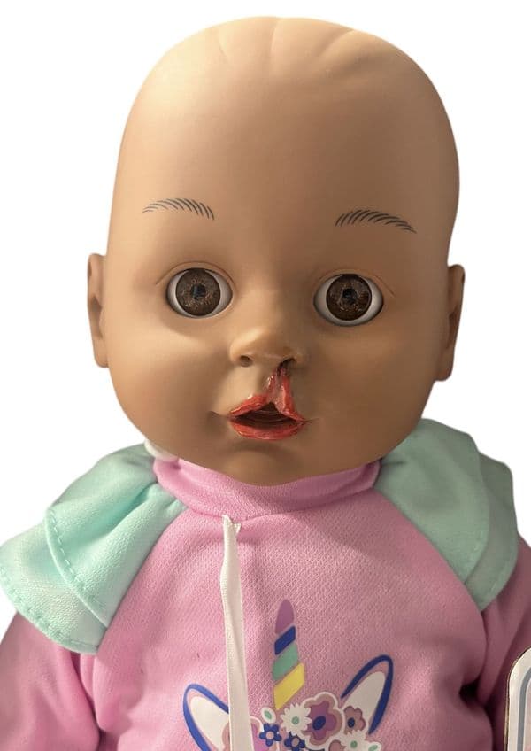 Cleft Lip Doll