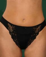 Pretty Lace Brief