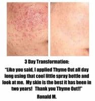 Thyme Out The Knockout Alternative For Eczema 8oz + 1/4oz To Go Bottle