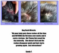 Thyme Out The Knockout Alternative For Eczema 8oz + 1/4oz To Go Bottle