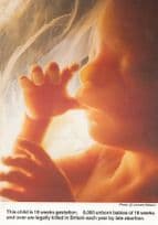 Anti Abortion Legal Age 1980s Protest Postcard