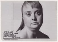 Gymnastics Sports Tennis Back Hand Learning Disability Postcard