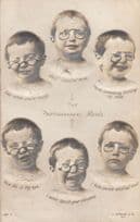 The Photographers Model Beagles Camera Man Rare Antique 3D Raised Head Postcard