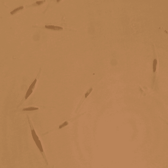 Live marine Phaeodactylum diatom microalgae 10-20 microns