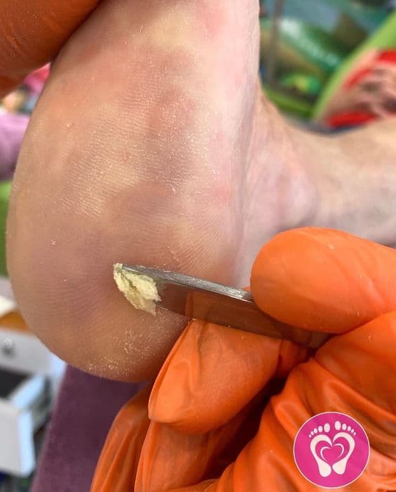 Kart Professional Pedicure Intermediate Level Course