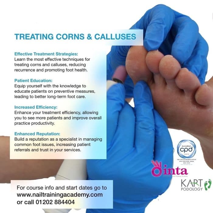 Treating Corns and Calluses