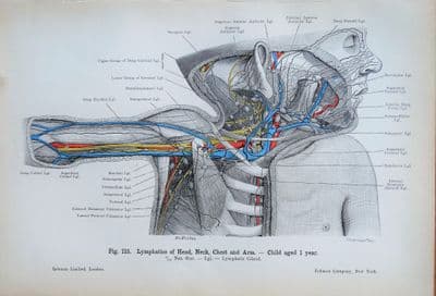 PAEDIATRIC LYMPHATIC SYSTEM  Original Antique Anatomy Lithographed Print 1906