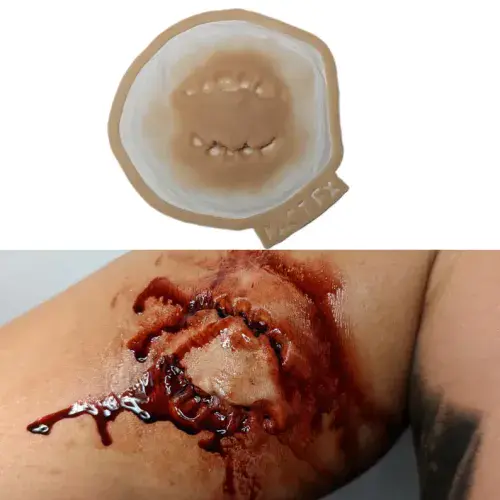 Bite Prosthetic | Kast FX