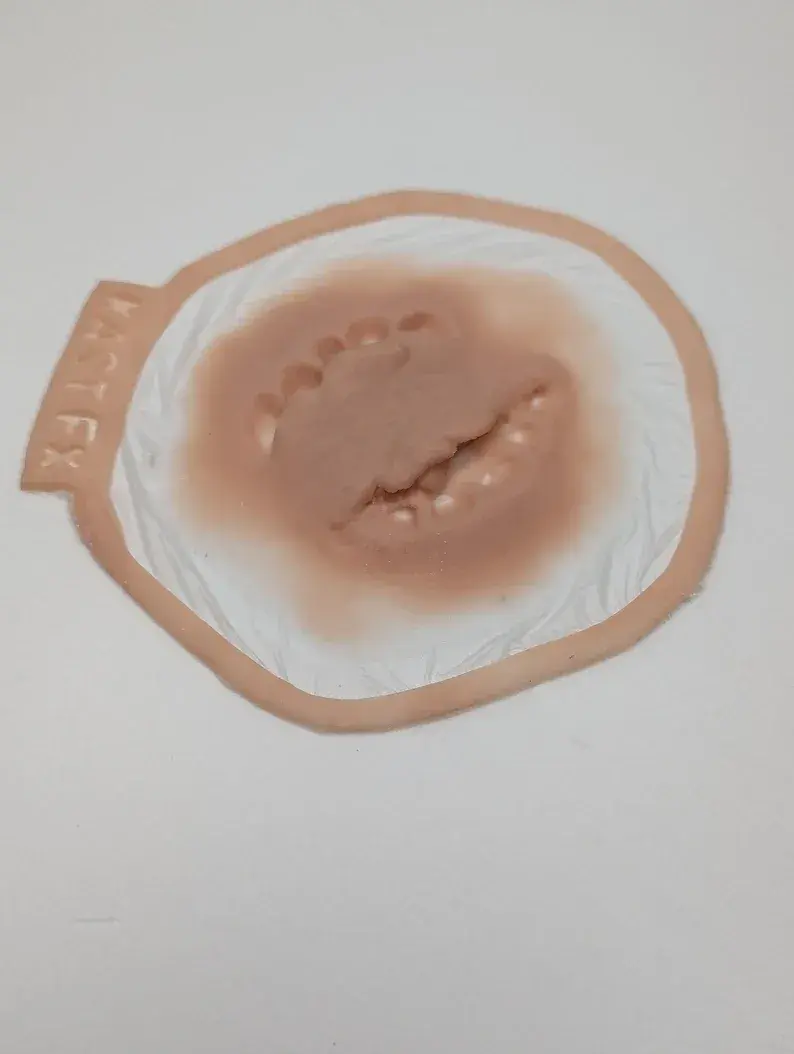 Bite Prosthetic | Kast FX