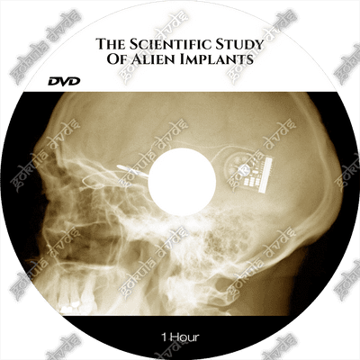 Scientific Study of Alien Implants [DVD - 60 mins.]