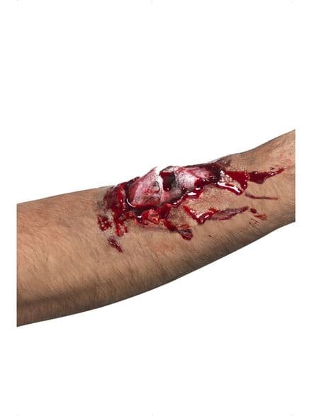 Latex Broken Bone Scar