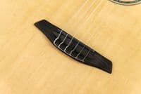 Furch GNC 4 SRa Nylon Spruce and Rosewood, inc Case
