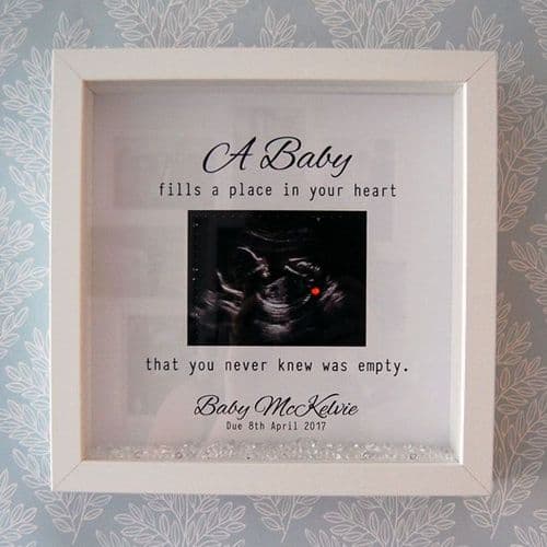 Personalised Scan Ultrasound Framed Print